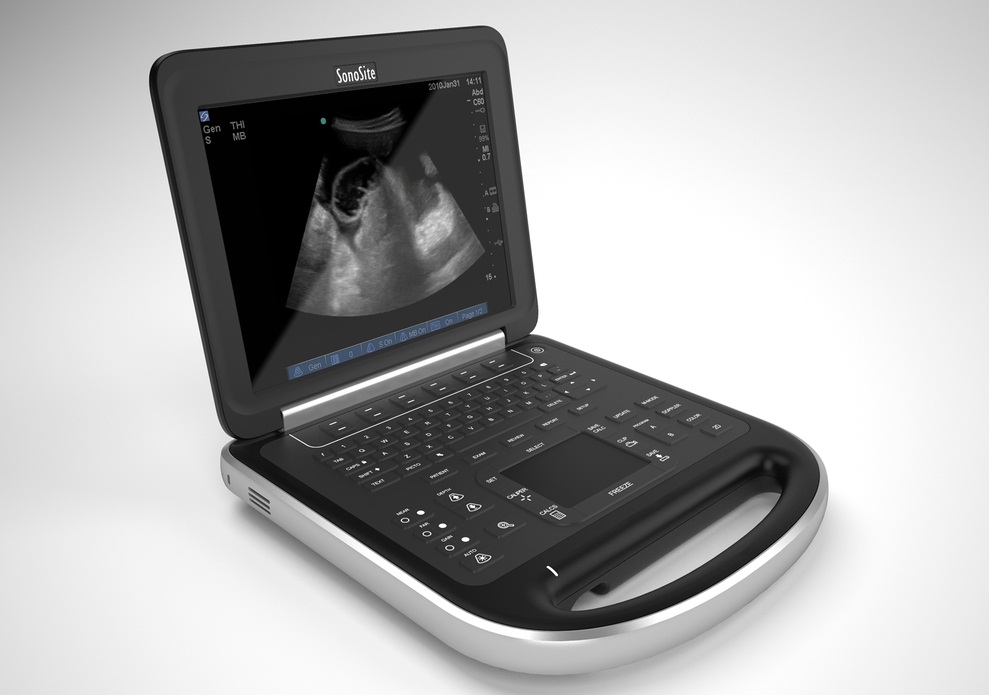 Edge portable. УЗИ sonosite. Sonosite Edge II. Sonosite портативный УЗИ. Sonosite Edge II С датчиком l38xi, l25.